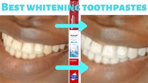 Magical whitening dental paste